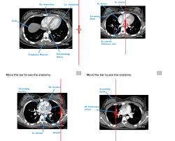 Arrt Exam Ct Prep Course